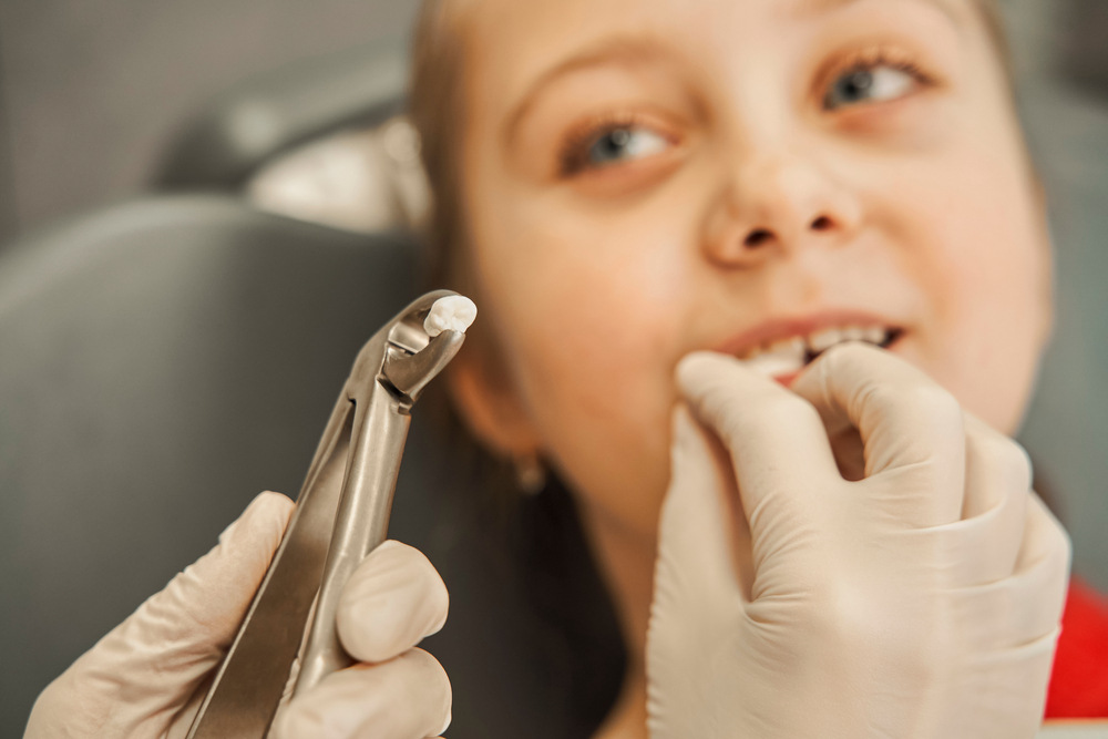 Extraccion de piezas dentales en Domus Dental 
